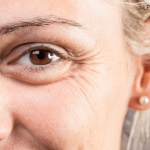Anti-aging