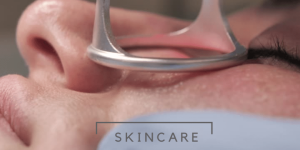 Co2 fractional laser Rijswijk, Den Haag voor rimpels