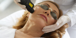 Collageen laser behandeling met Deka RedTouch voor huidversteviging en pigment bij Skincare Kliniek Rijswijk