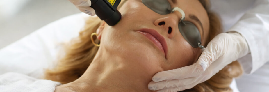 Collageen laser behandeling met Deka RedTouch voor huidversteviging en pigment bij Skincare Kliniek Rijswijk