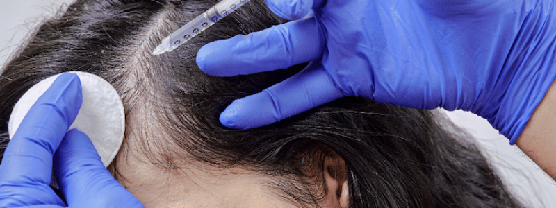 Hairfiller-Den-Haag-