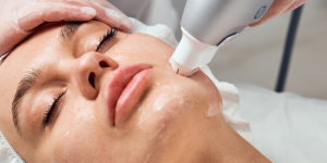 Hifu behandeling Rijswijk/ Den Haag / Delft/ Wateringen/ Nootdorp