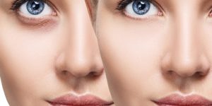 donkerekringen-klein