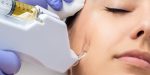 Skinbooster behandeling Rijswijk bij Skincare Kliniek